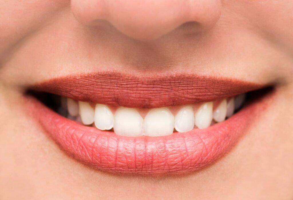 Porcelain veneers vs composite bonding results on front teeth in Houston